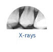 X-rays